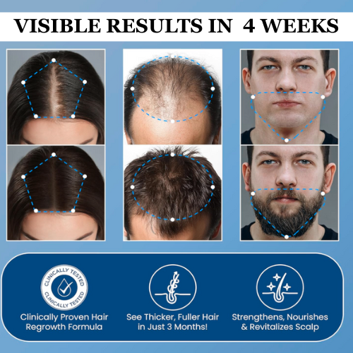 Hair Growth Serum Subscription Refill