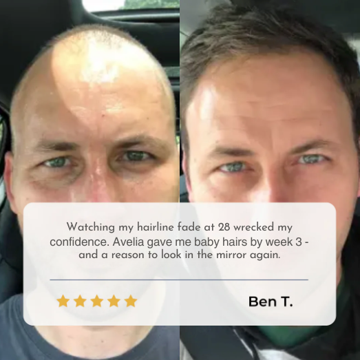 Hair Growth Serum Subscription Refill