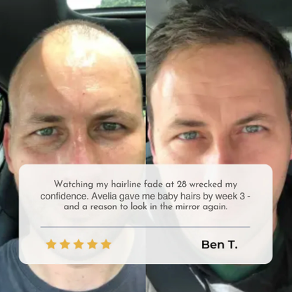 Hair Growth Serum Subscription Refill